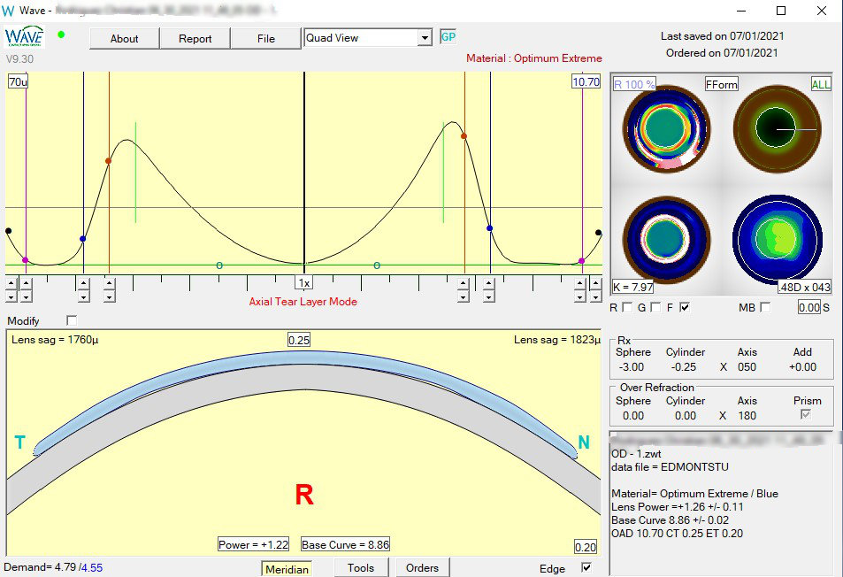 Wave custom contact lens design software